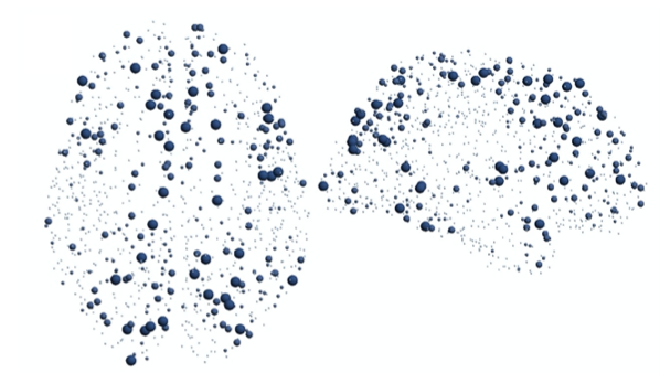 Graphing MRI data using network curvature enabled scientists at UCI, the University of Minnesota and other institutions to identify areas of robustness and weakness in neural networks, with diagnosis and treatment implications for aging and autism. Graphing MRI data using network curvature enabled scientists at UCI, the University of Minnesota and other institutions to identify areas of robustness and weakness in neural networks, with diagnosis and treatment implications for aging and autism.