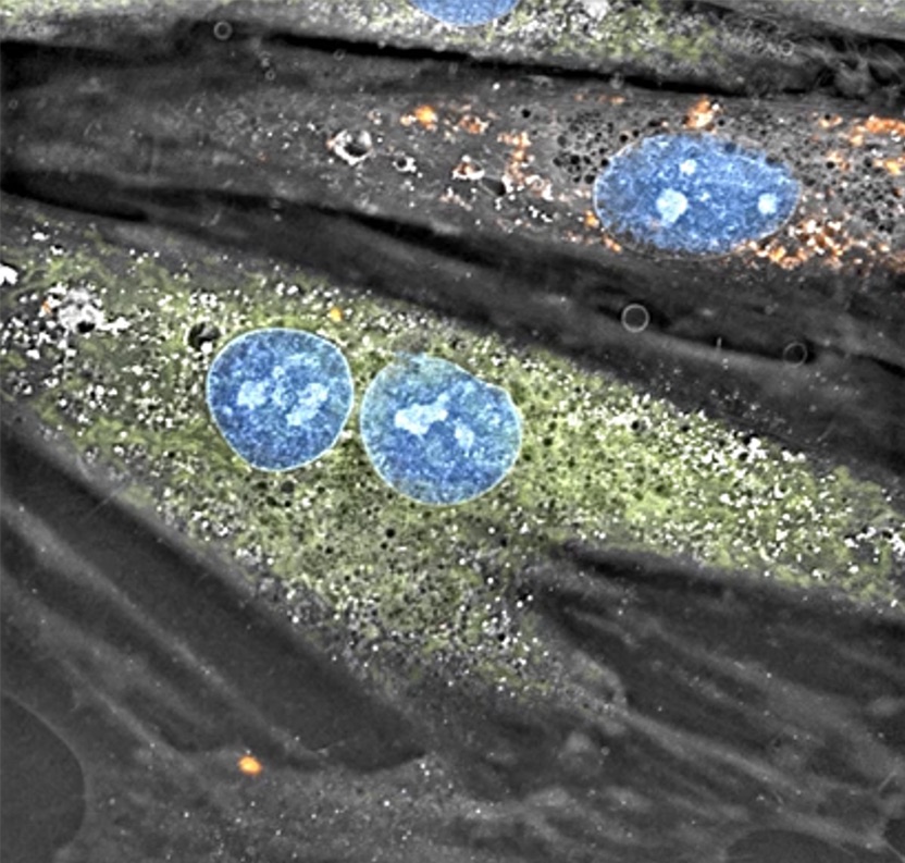 Mitochondria from a rat’s skeletal muscle cell (shown in red) were transplanted into cardiomyocytes, a demonstration by researchers in UCI’s Department of Biomedical Engineering of non-autologous mitochondria transplantation. Courtesy of Nanolive SA / Tolochenaz, Switzerland Mitochondria from a rat’s skeletal muscle cell (shown in red) were transplanted into cardiomyocytes, a demonstration by researchers in UCI’s Department of Biomedical Engineering of non-autologous mitochondria transplantation. Courtesy of Nanolive SA / Tolochenaz, Switzerland