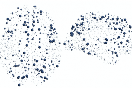 Graphing MRI data using network curvature enabled scientists at UCI, the University of Minnesota and other institutions to identify areas of robustness and weakness in neural networks, with diagnosis and treatment implications for aging and autism.